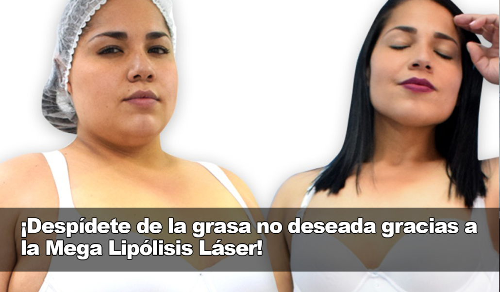La Mega Lipólisis Láser, un remedio eficaz para eliminar la grasa no deseada