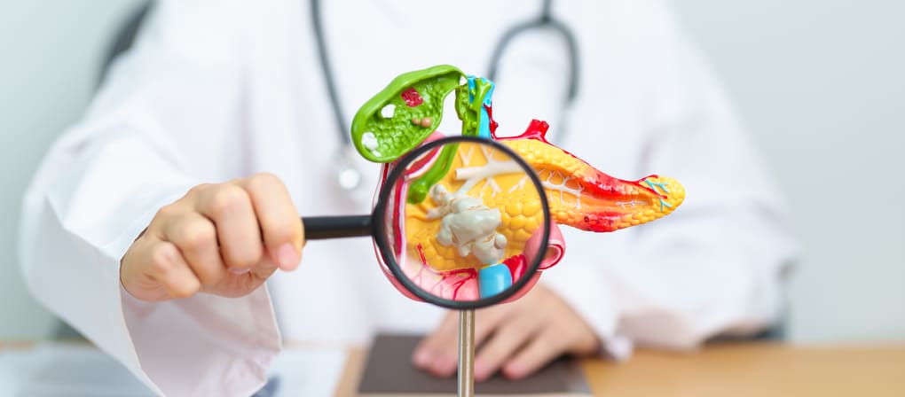 Quilomicronemia y pancreatitis: cómo prevenir riesgos en Guatemala